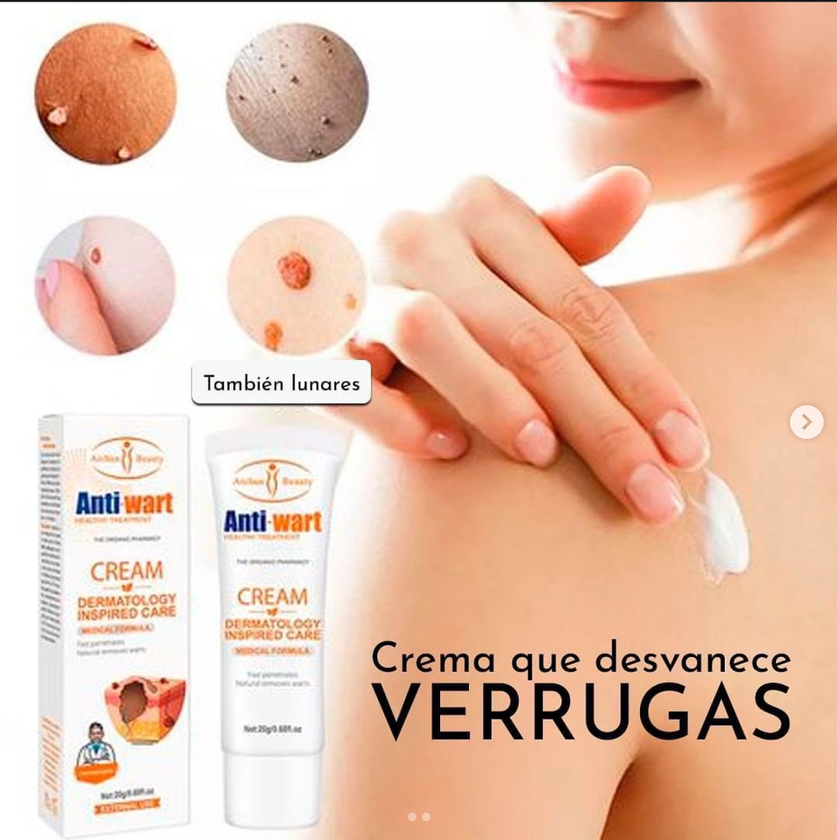 CREMA ELIMINACIÓN DE VERRUGAS